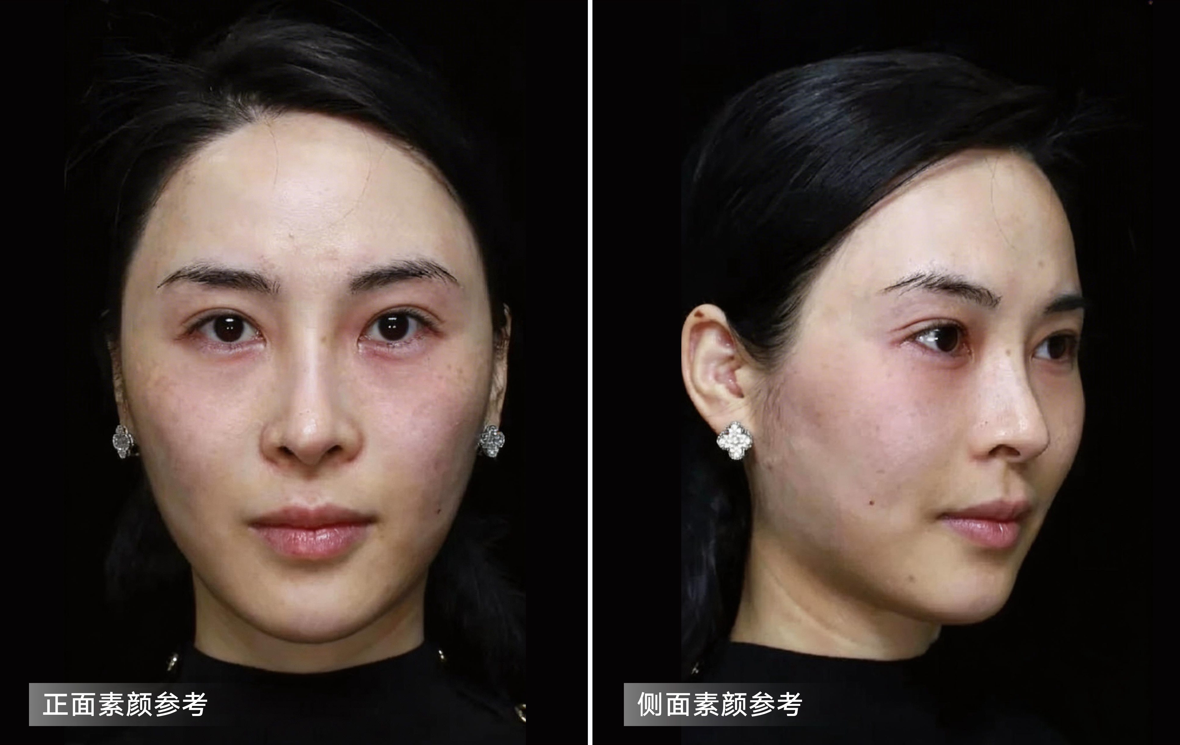示例照片